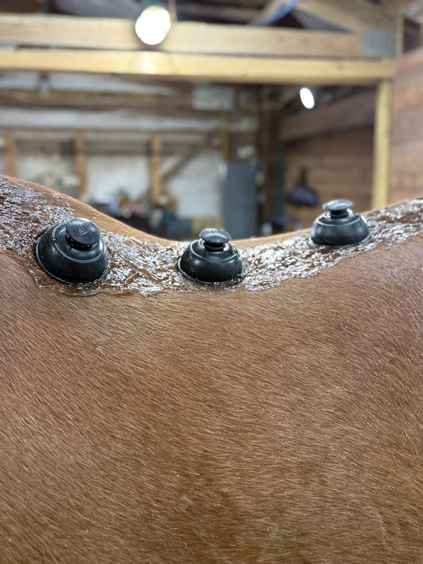 Cupping